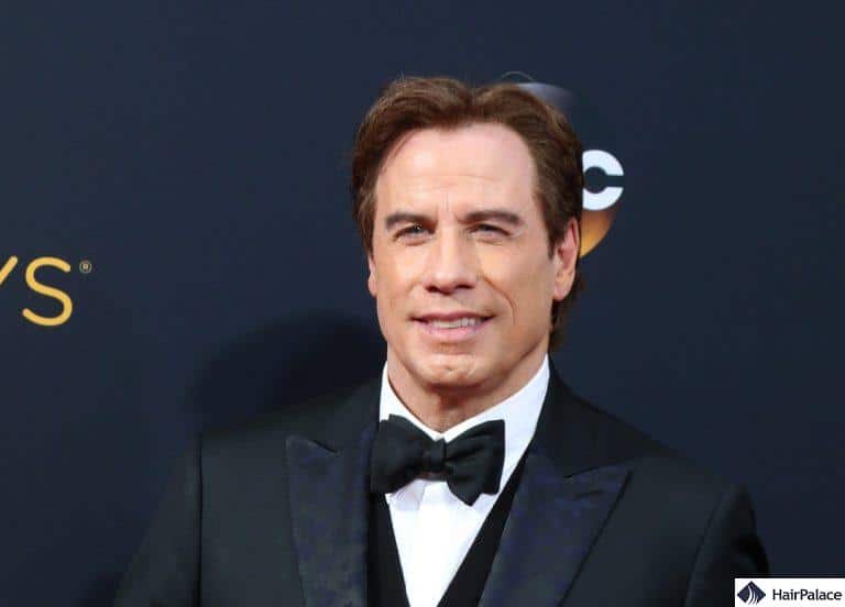 What's the truth of John Travolta's Hair Transplant? | HairPalace