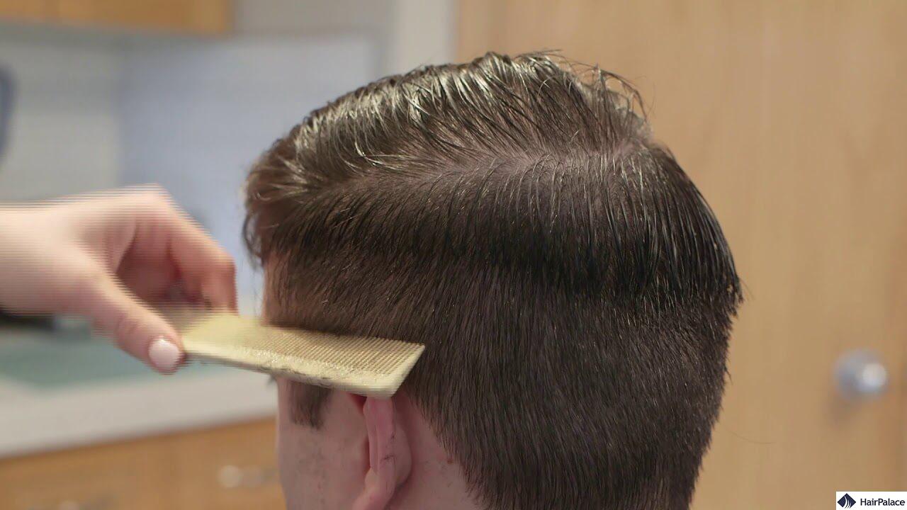 hair growth in men