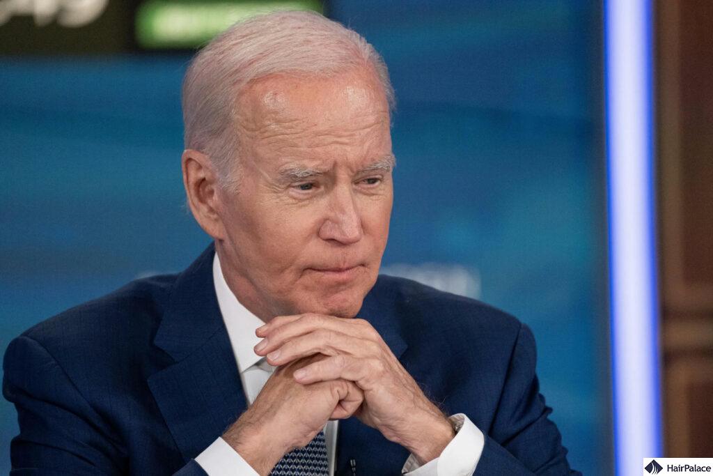 joe biden hairline