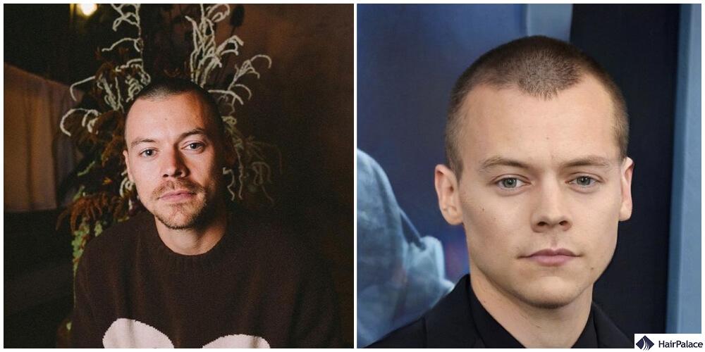 harry styles bald