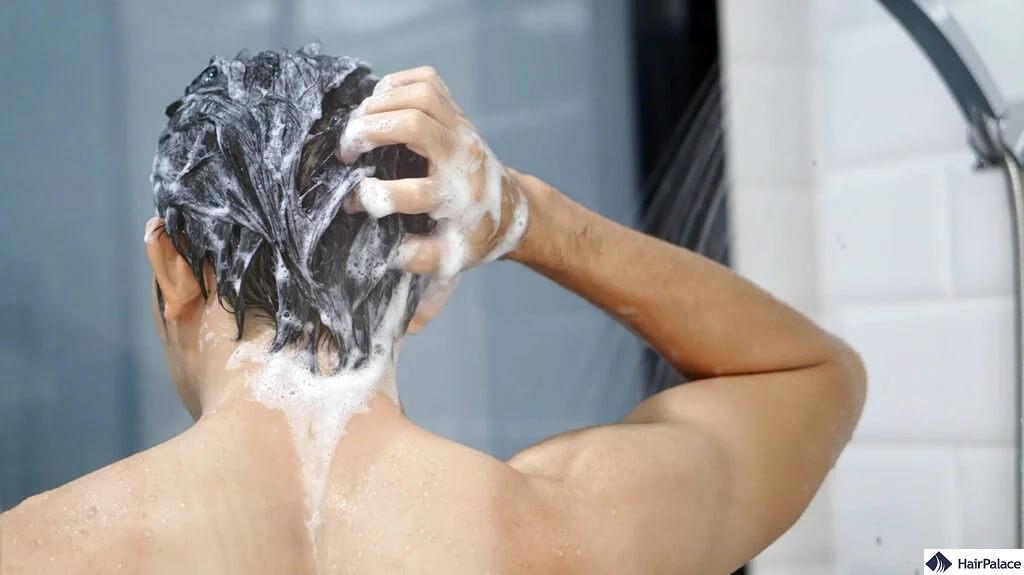 nizoral shampoo applied to the scalp