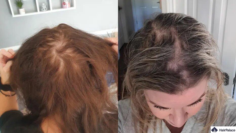 olaplex hair loss