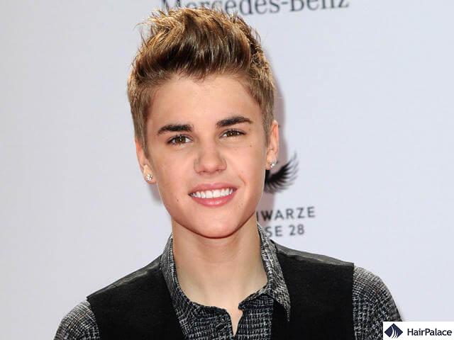 justin bieber hairline