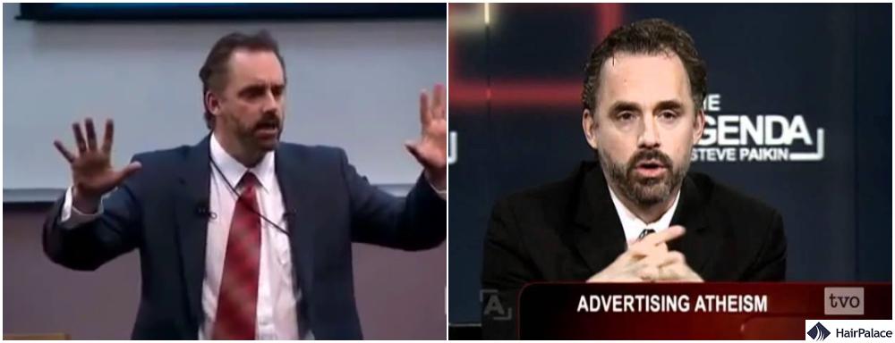 jordan peterson hair loss over the years