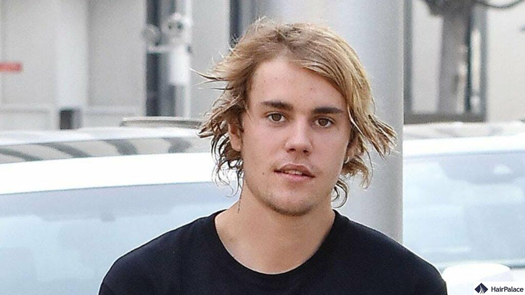 justin bieber receding hairline