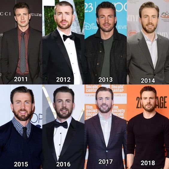 chris evans hair loss history