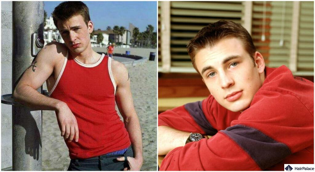 chris evans hair loss timeline