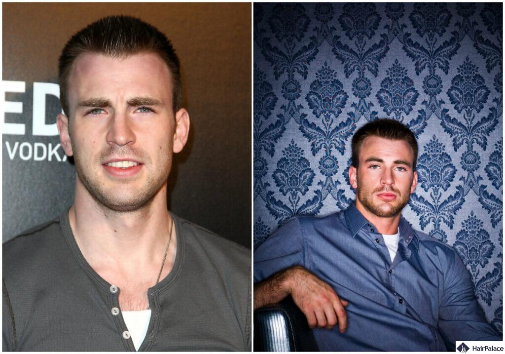 chris evans has a natural mature hairline