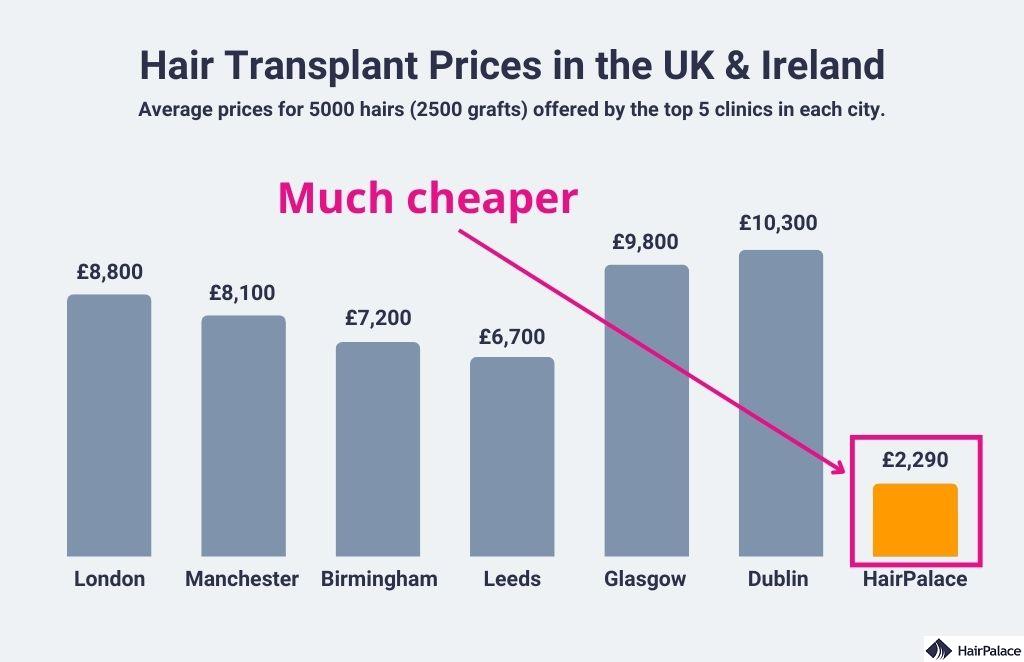 hair transplant cost UK