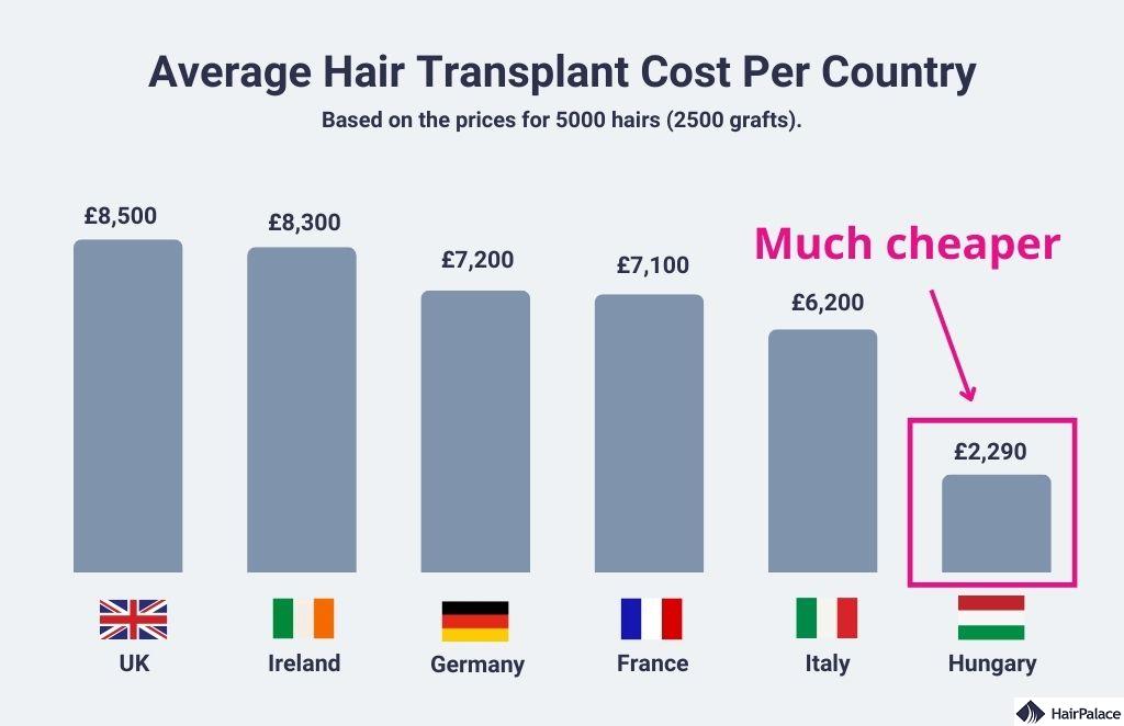 hair transplant cost around the world