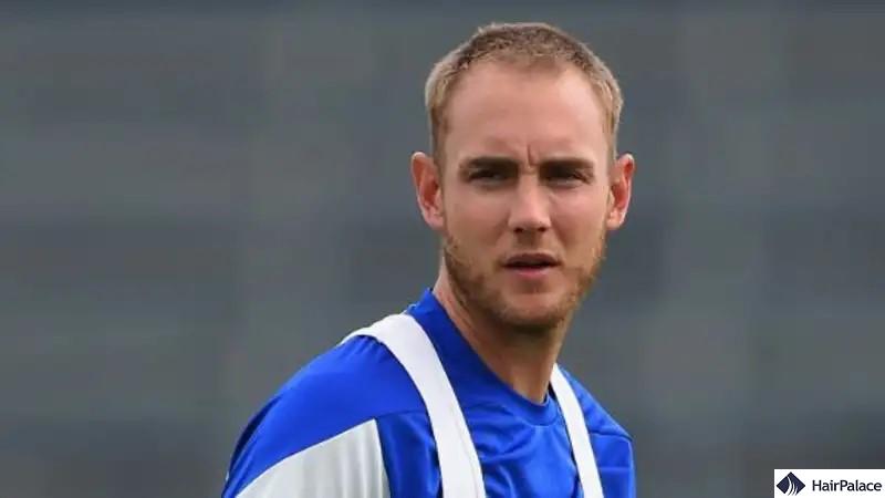 stuart broad hair loss story